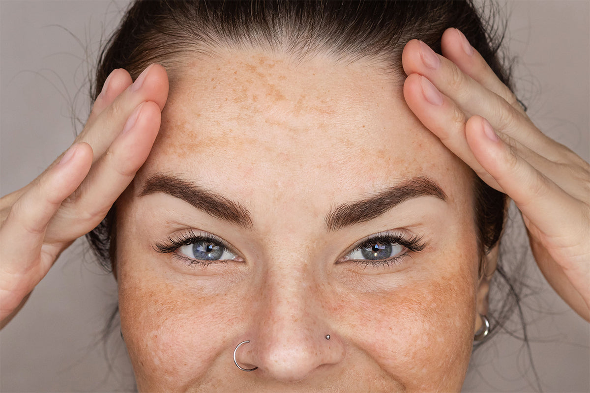 A rotina dia e noite para melasma resistente, explicada passo a passo